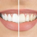 Cosmetic Dentistry in High Point, North Carolina