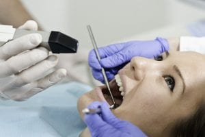 Fillings in Winston-Salem, North Carolina
