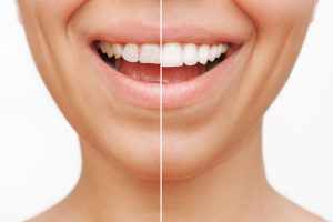 How a Cosmetic Dentist Can Transform Your Life