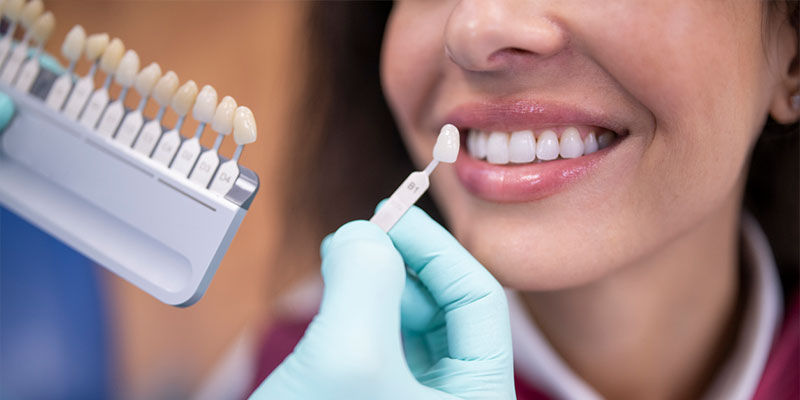 Understanding Dental Implants: A Comprehensive Guide